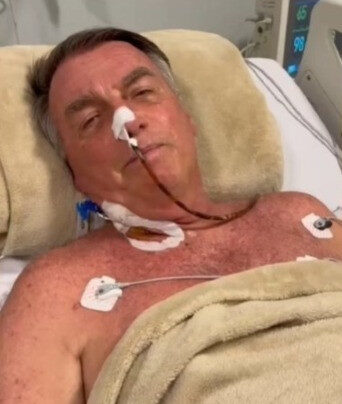 Bolsonaro enfrentou mais de 12 horas de cirurgia