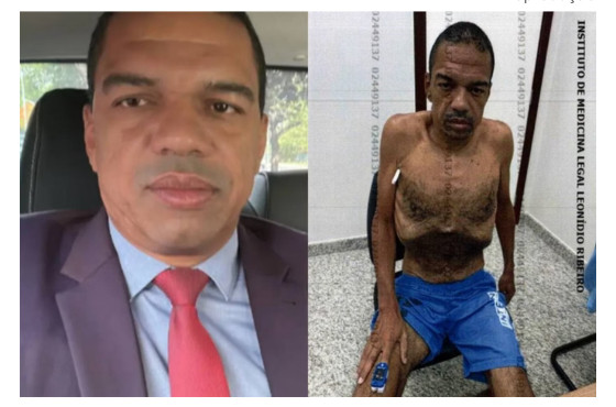 Imagem de lobista com corpo esquelético chocam