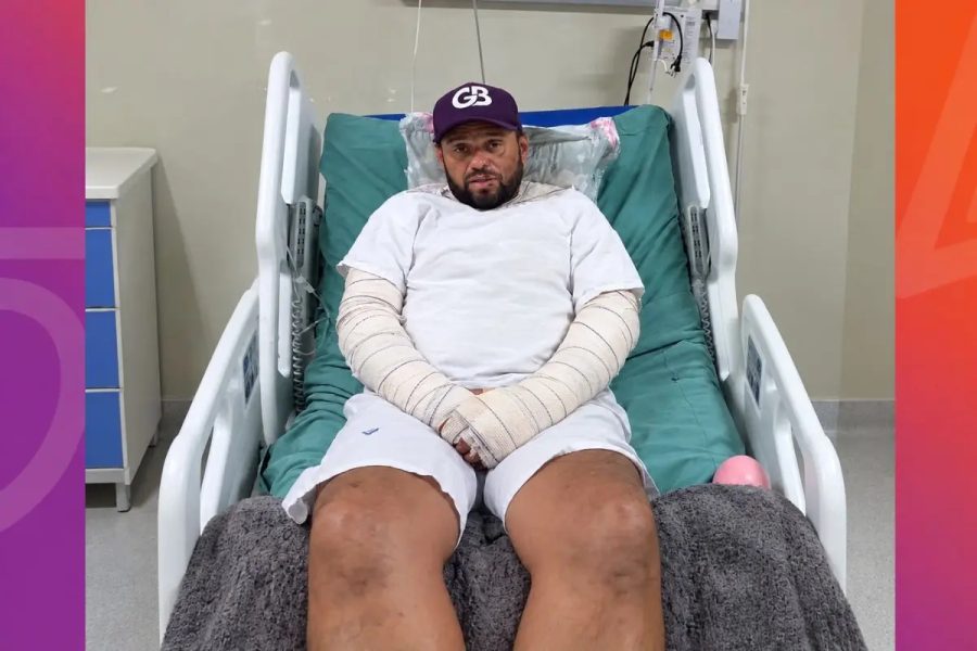 Vereador de MT permanece internado por queimaduras graves há uma semana