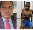 Imagem de lobista com corpo esquelético chocam